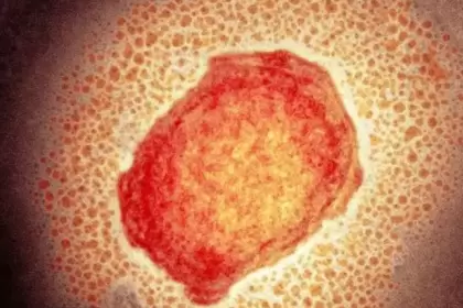 Imagen microscópica del virus.