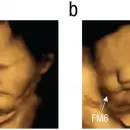 Analizaron cómo cambian las caras de los bebés en gestación en base a lo que comen sus madres: los hallazgos