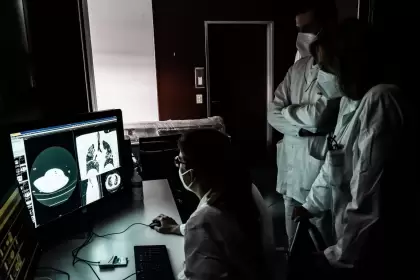 Radiólogos en Cremona, Italia, observan tomografías computarizadas de los pulmones de pacientes con Covid-19