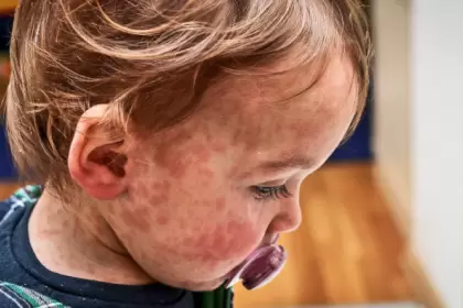EE.UU. en alerta roja tras detectarse la "enfermedad más infecciosa del mundo"