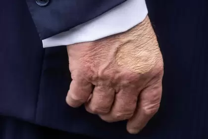 La mano derecha de Trump