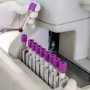 Tests genéticos para prevenir cáncer: la revolución silenciosa que ya llegó a Argentina