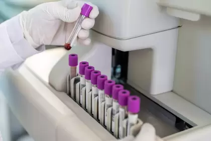 Tests genéticos para prevenir cáncer: