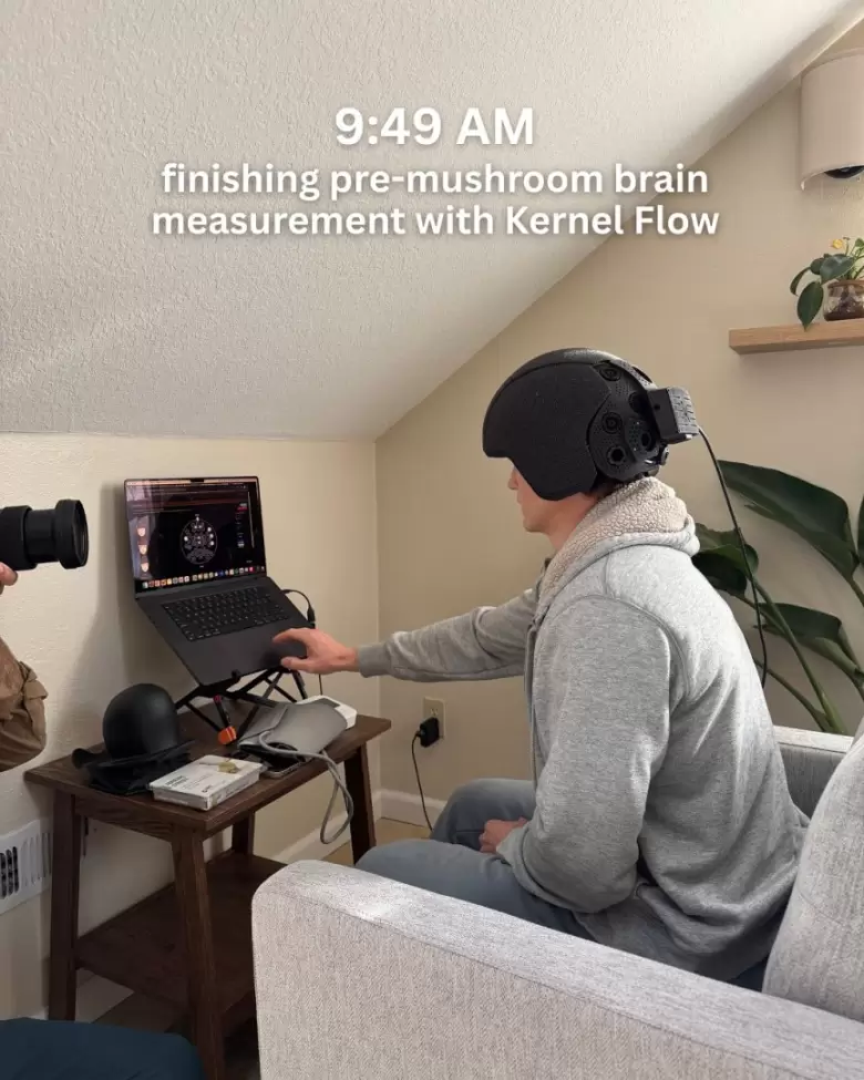 Una medición de actividad cerebral.