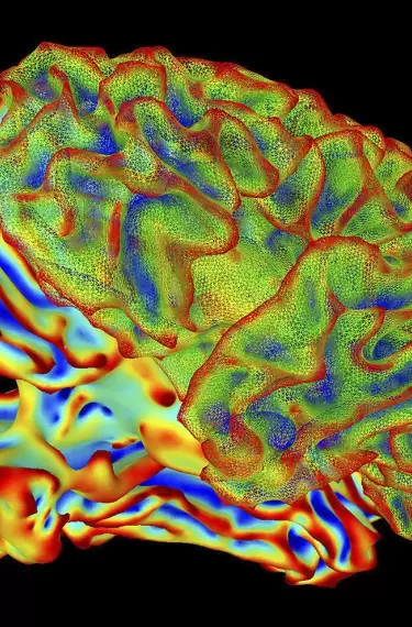 Un modelo de inteligencia artificial logró traducir con notable detalle la actividad cerebral en oraciones descriptivas.