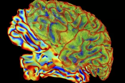 Un modelo de inteligencia artificial logró traducir con notable detalle la actividad cerebral en oraciones descriptivas.
