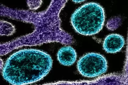 Se transmite por murciélagos y no tiene cura: el virus que preocupa al mundo