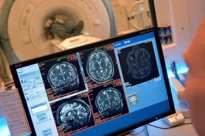 Deportes de contacto: descubren secuela cerebral que no se repara