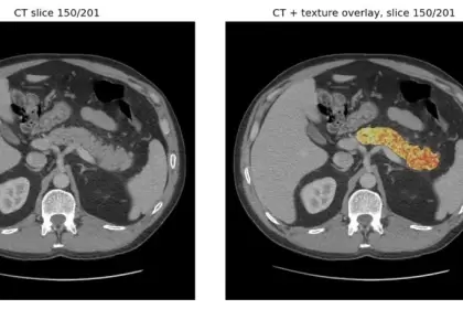 Detectan señales de cáncer hasta 3 años antes y podría cambiarlo todo